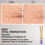 20 ML SHISEIDO WRINKLE SPOT TREATMENT A+ Intenzívna anti-aging starostlivosť  3 of 5 Intenzívna anti-aging starostlivosť