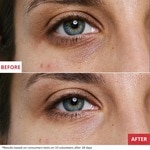 15 ML ERBORIAN SKIN THERAPY EYE Multifunkčný očný krém  2 of 3 Multifunkčný očný krém